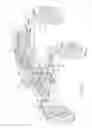Fig. 11 - Adjustable height device for high clearance vehicle