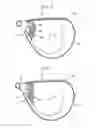 Fig. 04 - GOLF CLUB HEAD