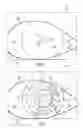 Fig. 03 - Surgical microscopy system and method for performing eye surgery
