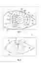 Fig. 04 - Surgical microscopy system and method for performing eye surgery