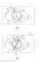 Fig. 05 - Surgical microscopy system and method for performing eye surgery