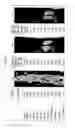 Fig. 17 - Dock-and-lock (DNL) complexes for therapeutic and diagnostic use