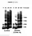 Fig. 08 - Compound that can inhibit UBC13-UEV interactions, pharmaceutical compositions and therapeutic uses