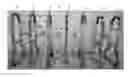 Fig. 01 - PORTABLE COLLAPSIBLE BARRIER