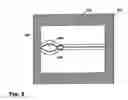 Fig. 04 - CLOSABLE APERTURE FOR RETROFITTING TO A CONTAINER