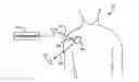 Fig. 01 - Patient Event Marking in Combination with Physiological Signals