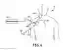 Fig. 07 - Patient Event Marking in Combination with Physiological Signals