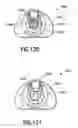 Fig. 76 - Safety blood collection assembly with indicator
