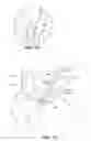 Fig. 09 - System and method for transvascularly stimulating contents of the carotid sheath