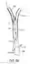 Fig. 07 - Methods and systems for establishing retrograde carotid arterial blood flow