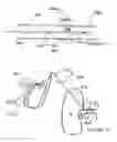 Fig. 09 - METHODS AND APPARATUS FOR INDUCING CONTROLLED RENAL NEUROMODULATION