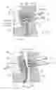 Fig. 02 - Method and device for producing a toothbrush by the two-component or multi-component injection-molding process