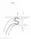 Fig. 26 - Exhaust gas purifying device