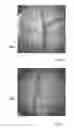 Fig. 06 - Method and apparatus for obtaining an image of an ocular feature