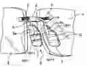 Fig. 01 - Nose bearing assembly for spectacles, and spectacles including same