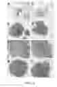 Fig. 15 - MICROTRENCH AND TUMOUR PROLIFERATION ASSAY