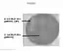 Fig. 05 - Preparation of an esterase