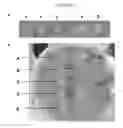 Fig. 06 - Preparation of an esterase