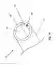 Fig. 11 - Irrigation and aspiration device and method