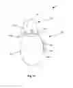 Fig. 15 - Irrigation and aspiration device and method
