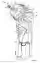 Fig. 17 - Irrigation and aspiration device and method