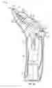 Fig. 18 - Irrigation and aspiration device and method
