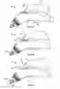 Fig. 28 - Irrigation and aspiration device and method