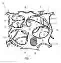 Fig. 02 - High performance reticulated elastomeric matrix preparation, properties, reinforcement, and use in surgical devices, tissue augmentation and/or tissue repair
