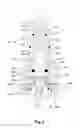 Fig. 04 - Swayable and retractable shower