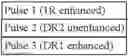 Fig. 04 - Pulsatile Release of Valsartan