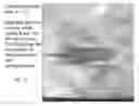 Fig. 18 - System and method for estimating the height of an object using tomosynthesis-like techniques