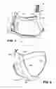 Fig. 02 - Headgear for masks