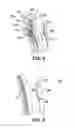 Fig. 05 - Reverse flow tolerant spring activated brush seal