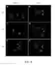Fig. 05 - METHODS AND COMPOSITIONS FOR THE TREATMENT OF LUNG DISEASES AND DISORDERS