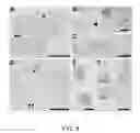 Fig. 06 - METHODS AND COMPOSITIONS FOR THE TREATMENT OF LUNG DISEASES AND DISORDERS