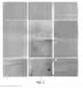 Fig. 03 - Method of treating heart tissue using induced pluripotent stem cells
