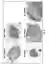 Fig. 05 - Method of treating heart tissue using induced pluripotent stem cells