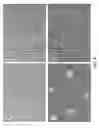 Fig. 07 - Method of treating heart tissue using induced pluripotent stem cells