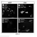 Fig. 08 - Method of treating heart tissue using induced pluripotent stem cells