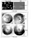 Fig. 19 - Method of treating heart tissue using induced pluripotent stem cells