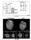Fig. 30 - Method of treating heart tissue using induced pluripotent stem cells