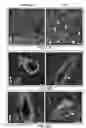 Fig. 32 - Method of treating heart tissue using induced pluripotent stem cells
