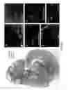 Fig. 43 - Method of treating heart tissue using induced pluripotent stem cells