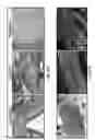 Fig. 47 - Method of treating heart tissue using induced pluripotent stem cells