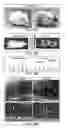 Fig. 55 - Method of treating heart tissue using induced pluripotent stem cells