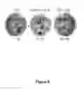 Fig. 07 - Drug delivery to human tissues by single chain variable region antibody fragments cloned by phage display