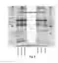 Fig. 06 - System and method for conditioning implantable medical devices