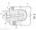 Fig. 09 - Therapeutic tooth bud ablation