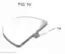 Fig. 06 - Improved Dental Model Baseplate