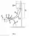 Fig. 02 - Cannulation simulator